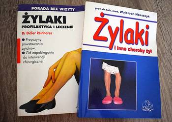 Żylaki - leczenie , profilaktyka , przyczyny , objawy - zestaw 2 książek