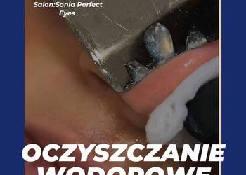 Oczyszczanie wodorowe
