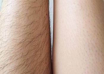 Dopilacja cukrowa Naturalna gładkość bez podrażnień