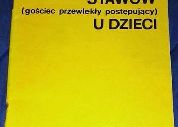 Reumatoidalne zapalenie stawów u dzieci - W. Szymańska, K. Kujawska