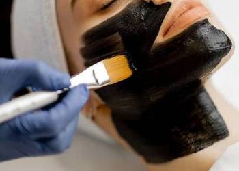 Peeling węglowy – koniec z niedoskonałościami i zaskórnikami