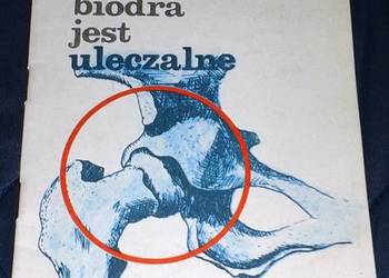 Wrodzone zwichnięcie biodra jest uleczalne - Karol Bednarczyk