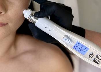 Sprzedam Derma EPN - mezoterapia mikroigłowa z elektroporacją + 28 szt kart