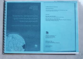 nowotwory zębopochodne i guzy nowotworopodobne kości szczęki