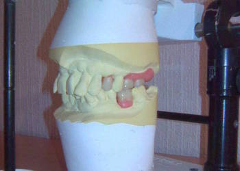 Artykulator dentystyczny protetyczny do montażu protez dentystycznych