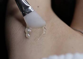 Depilacja laserowa gładkość na codzień