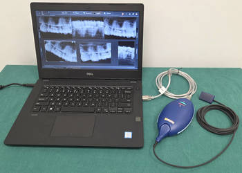 Radiowizjografia RVG Sirona Xios PLUS (Rozm. 1) + Laptop Dell - rentgen rtg