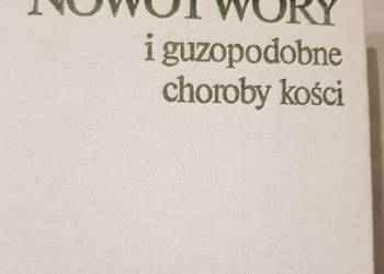 Nowotwory i guzopodobne choroby kości  Dominok  Knoch medycy