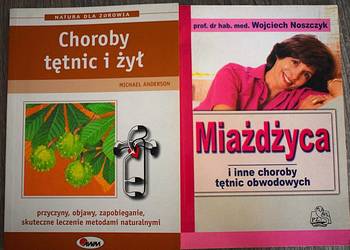 Miażdżyca ,choroby żył i tętnic- przyczyny ,objawy, leczenie i zapobieganie