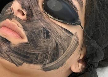 Peeling węglowy – skuteczny sposób na trądzik i przebarwienia