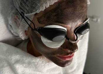 Peeling węglowy – sekret promiennej cery