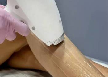 Laserowa depilacja – gładka skóra już od 150 zł!