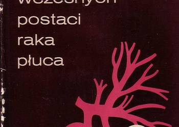 (5453) RADIODIAGNOSTYKA WCZESNYCH POSTACI RAKA PŁUC – DOC. DR MED. JANUSZ BURACZEWSKI, DR MED. TADEUSZ LEWIŃSKI