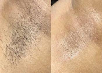 Depilacja cukrowa Pokochaj swoją skórę na nowo