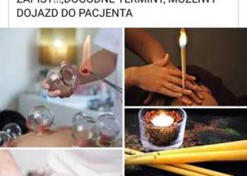Stawianie baniek ogniowych i nie tylko