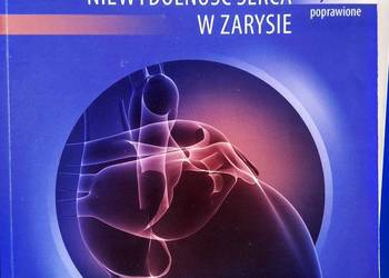 Ostra niewydolność serca w zarysie medycyna podręczniki